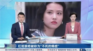 红斑狼疮被称“不死的癌症” 尤其偏爱女性